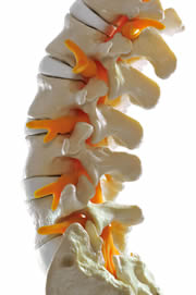 Lumbalgia o dolor de la espalda baja, una epidemia de este siglo