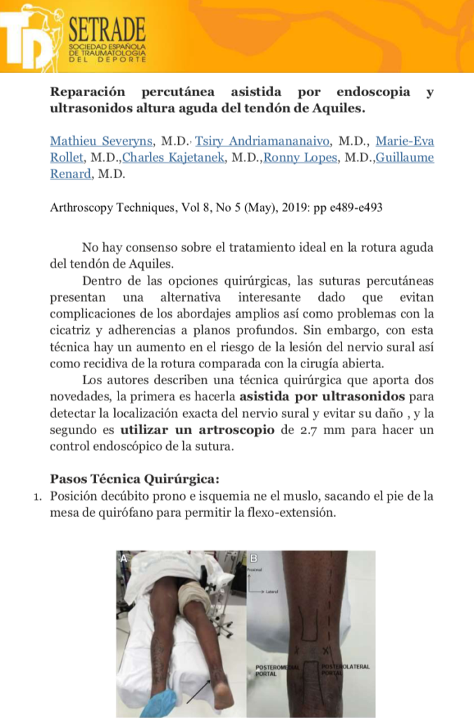 Acute Achilles Tendon Rupture Ultrasonography and Endoscopy Assisted Percutaneous Repair 1
