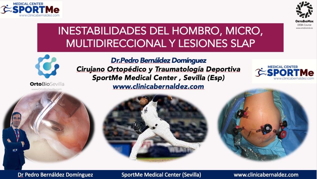 Ponencia Dr Bernaldez INESTABILIDADES DEL HOMBRO, MULTI, MICRO INESTABILIDADES Y LESIONES SLAP