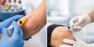 PRP vs corticoides en tendinitis