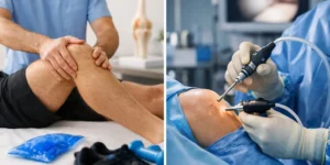 Fisioterapia o cirugía de menisco según tu lesión